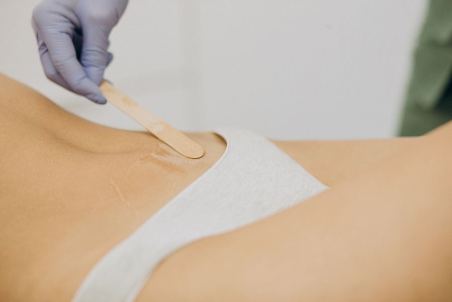 Application de cire sur une zone sensible du corps illustrant les précautions à prendre lors de l’épilation pour éviter irritations et rougeurs